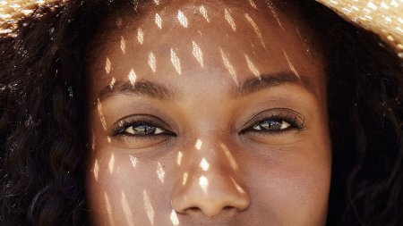 Do you have dark spots on your face or body?