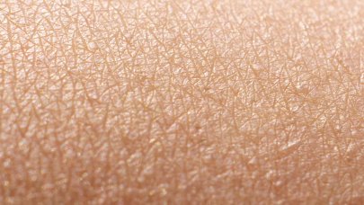 Photo of skin with a healthy skin barrier